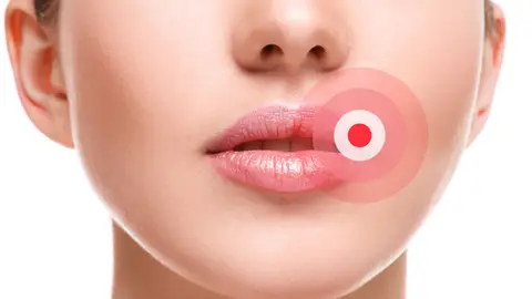 Primer plano del rostro de una mujer con una señal en la comisura de la boca. Primer plano del rostro de una mujer con una señal en la comisura de la boca.