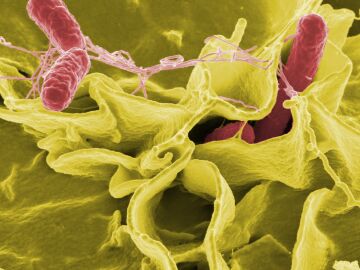 Las infecciones bacterianas son ya la segunda causa de muerte en el mundo