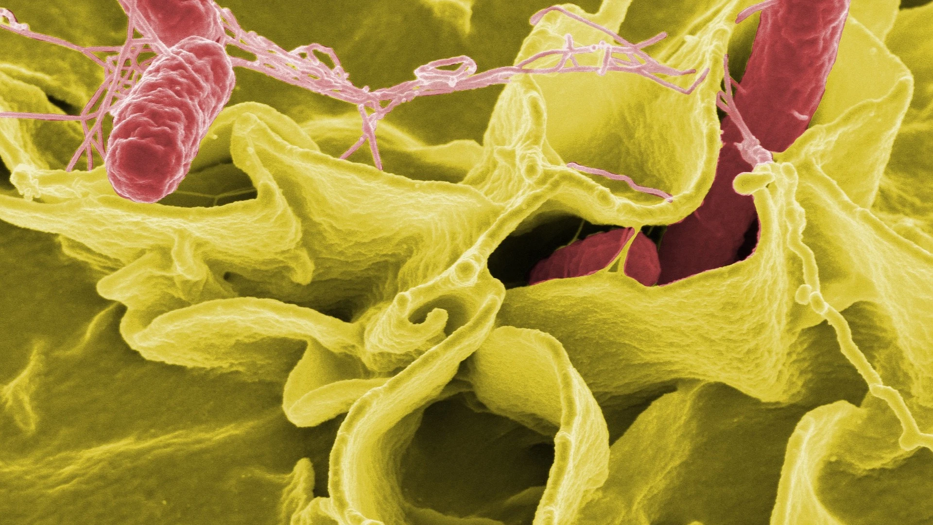 Las infecciones bacterianas son ya la segunda causa de muerte en el mundo