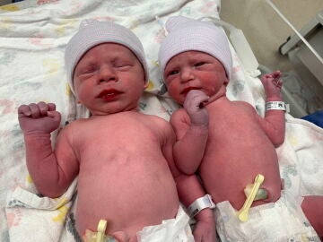 Nacimiento de dos bebés de embriones congelados hace más de 30 años