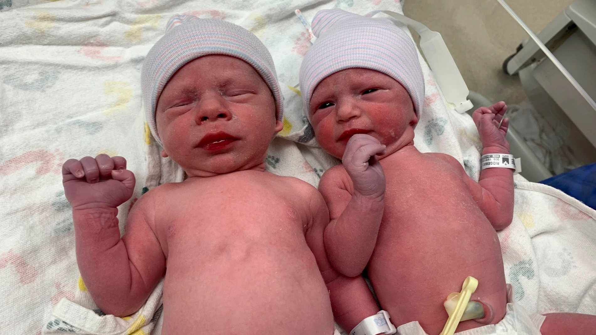 Nacimiento de dos bebés de embriones congelados hace más de 30 años