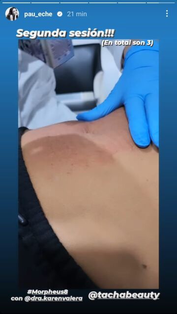 Paula Echevarría muestra el tratamiento al que se está sometiendo 