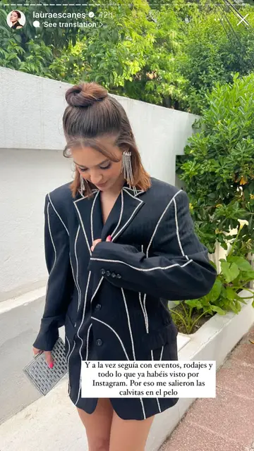Laura Escanes explica qué fue lo que le llevó a sufrir una pérdida del cabello Laura Escanes explica qué fue lo que le llevó a sufrir una pérdida del cabello
