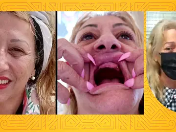 Fue a Estambul a operarse el pecho y volvió sin dientes: "Estoy desesperada, no puedo ni dormir" Fue a Estambul a operarse el pecho y volvió sin dientes: "Estoy desesperada, no puedo ni dormir"