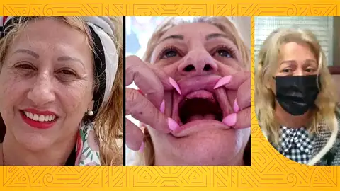 Fue a Estambul a operarse el pecho y volvió sin dientes: "Estoy desesperada, no puedo ni dormir" Fue a Estambul a operarse el pecho y volvió sin dientes: "Estoy desesperada, no puedo ni dormir"