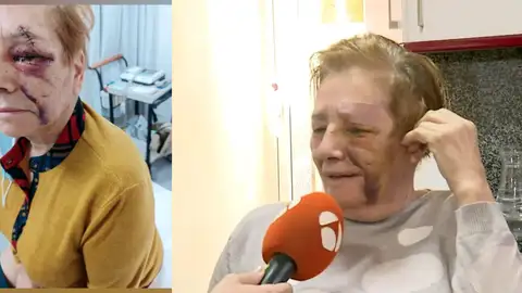 Gravemente heridas tras ser atacada por perros. Gravemente heridas tras ser atacada por perros.