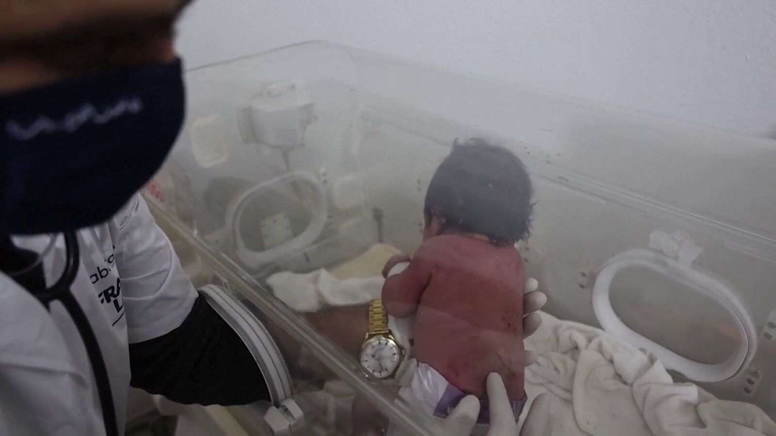 La bebé nacida entre los escombros del terremoto se recupera con hematomas, pero ha perdido a toda su familia 