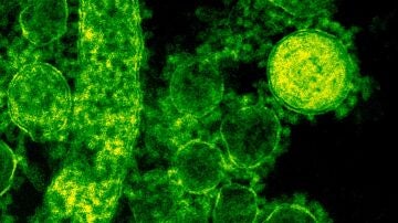 Virus
