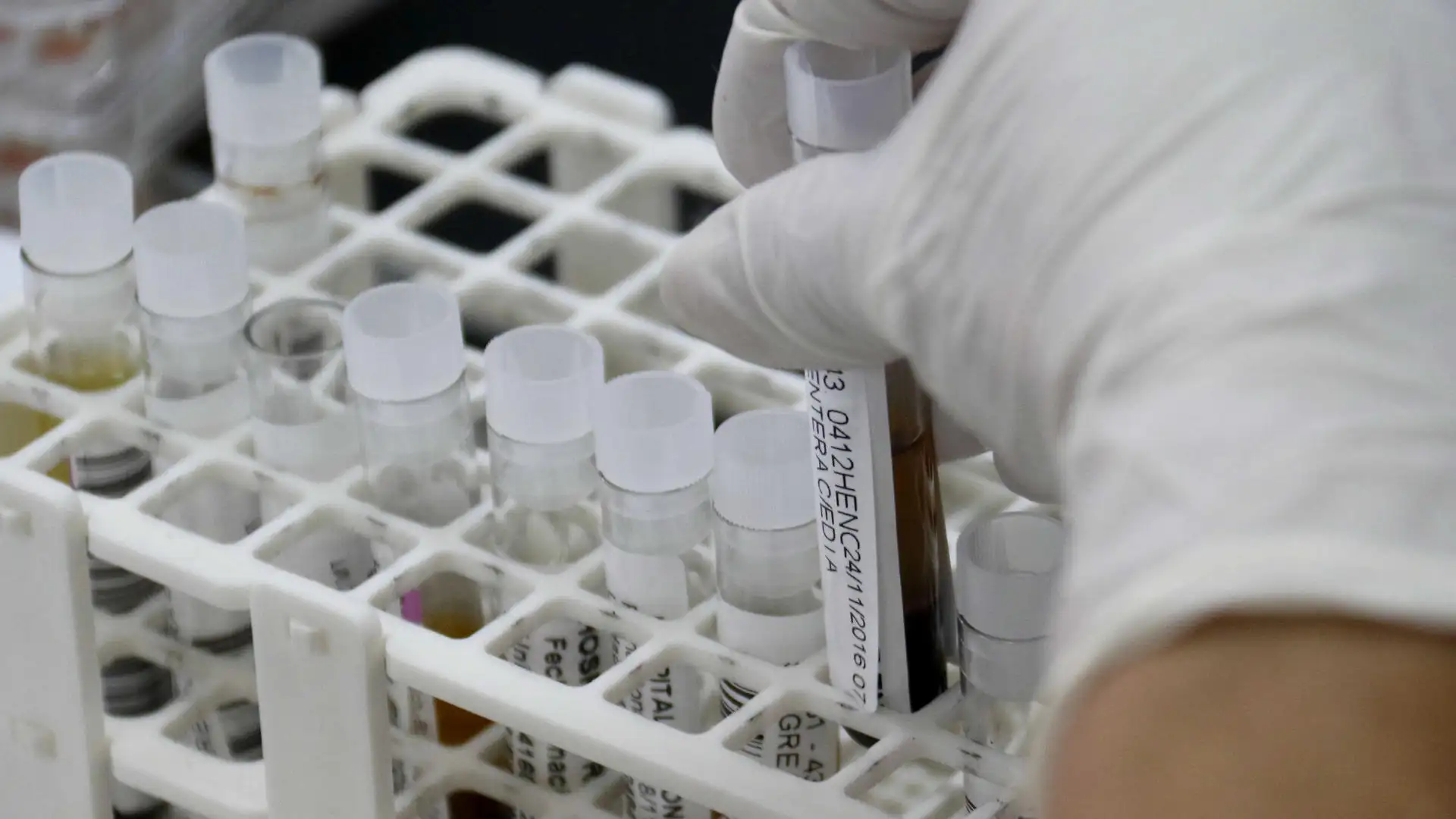 Un nuevo metodo permite diagnosticar cancer de mama con una gota de sangre