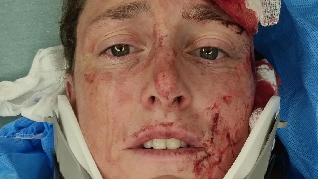Kat Matthews La triatleta, tras el accidente