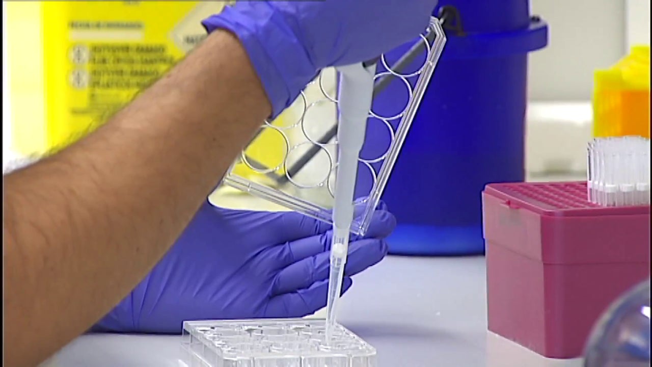 Scientists find a protein to slow the metastasis of lung cancer