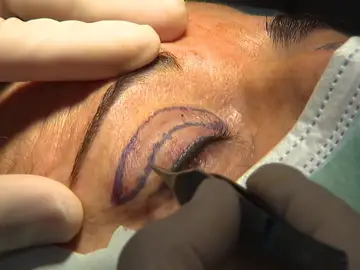 Clínica estética Clínica estética