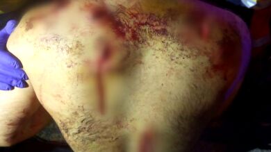 La imagen de las brutales heridas de la batalla campal en Badalona con 7 detenidos