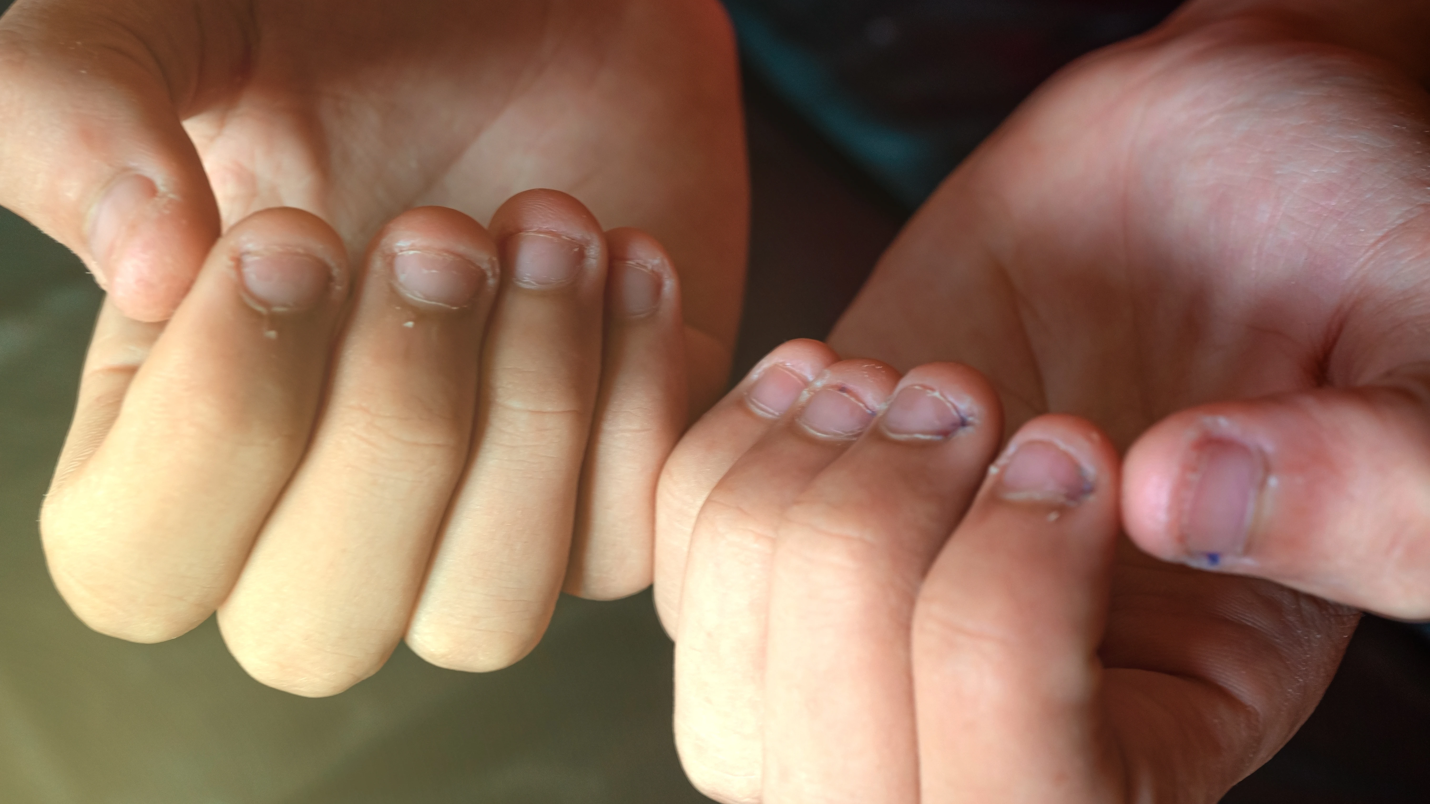 U&ntilde;as mordidas