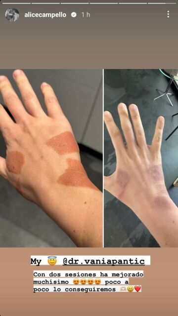 Marcas Alice Campello