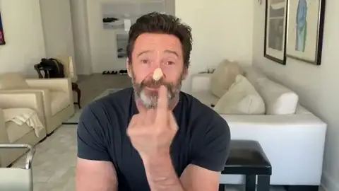 El actor Hugh Jackman vuelve a luchar contra el cáncer de piel El actor Hugh Jackman vuelve a luchar contra el cáncer de piel