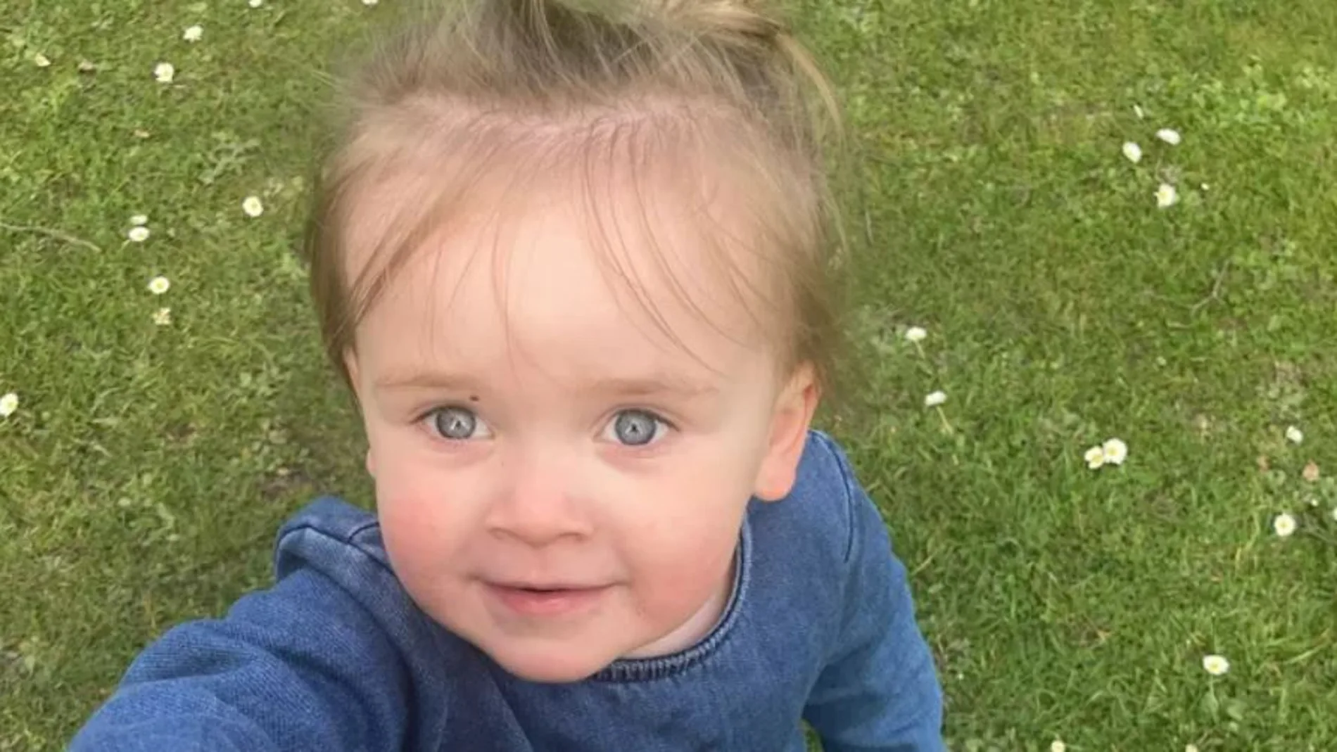 Imagen de la pequeña con cáncer Imagen de la pequeña con cáncer