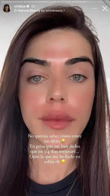 Violeta Mangriñán enseña cómo avanzan sus manchas Violeta Mangriñán enseña cómo avanzan sus manchas