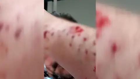 Imagen de las heridas provocadas por el pitbull Imagen de las heridas provocadas por el pitbull