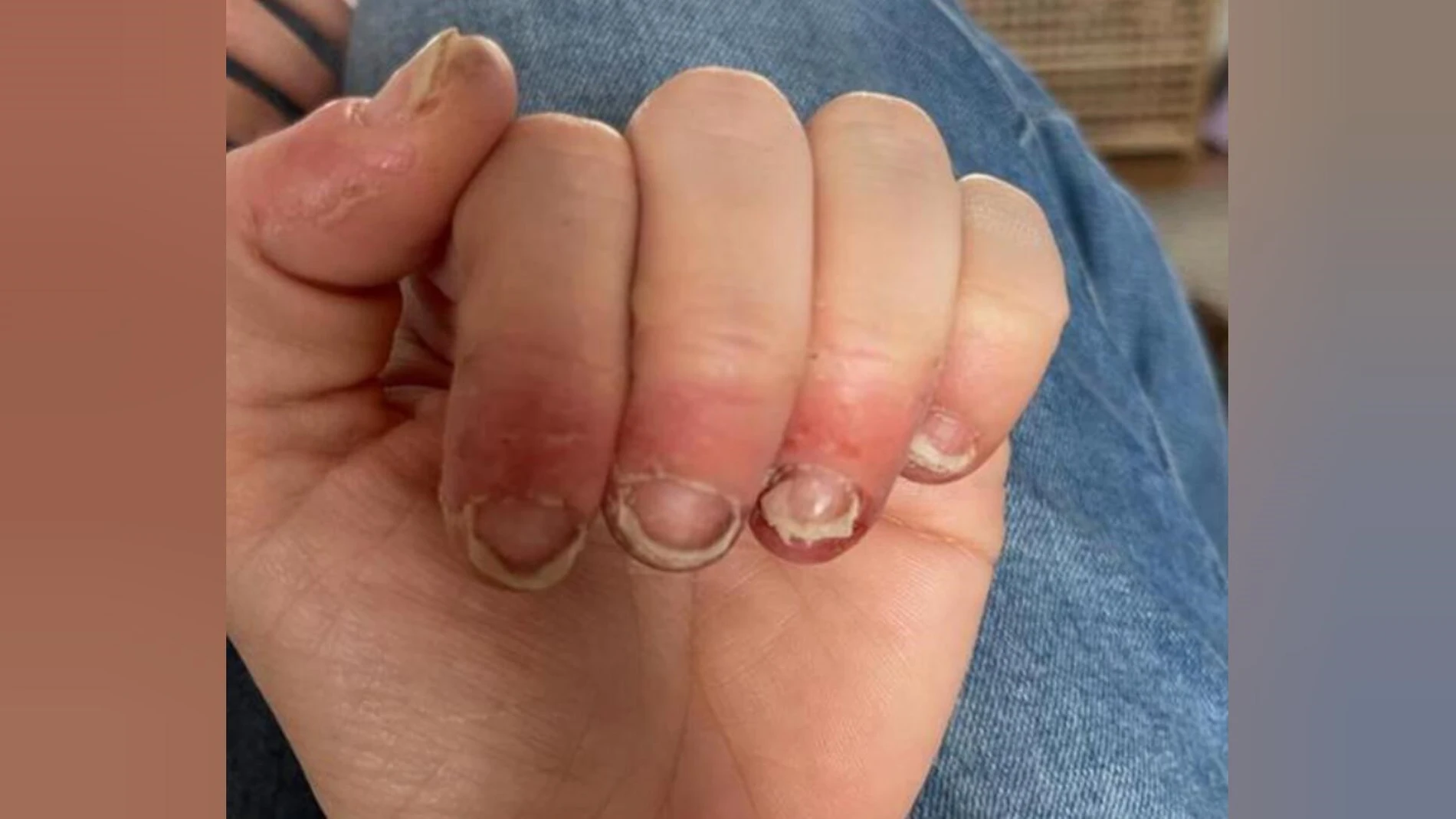 Las uñas de Lisa Dewey