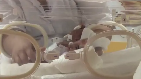 Los nacimientos prematuros son la principal causa de mortalidad infantil Los nacimientos prematuros son la principal causa de mortalidad infantil