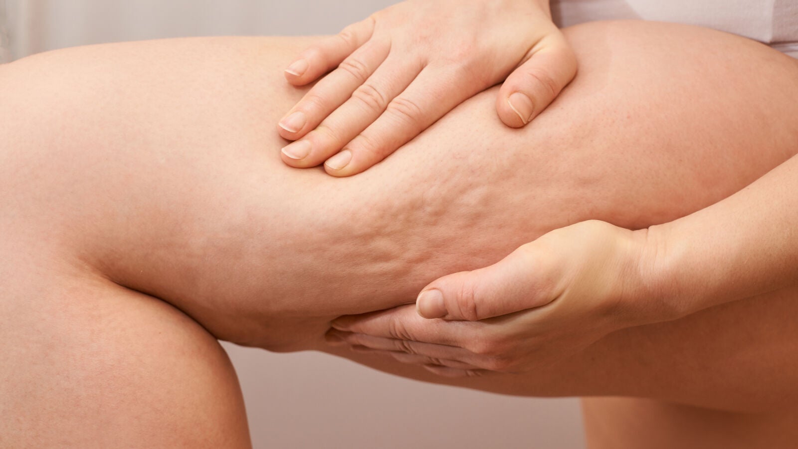 Ejercicios que funcionan contra la retención de líquidos y la celulitis en las piernas