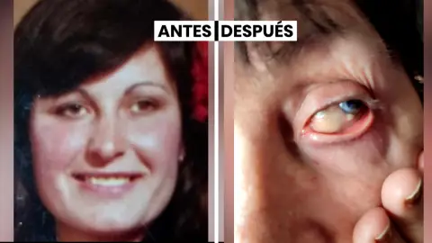 El ojo de Domi antes y después de la operación