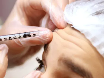 Inyección de bótox Inyección de bótox