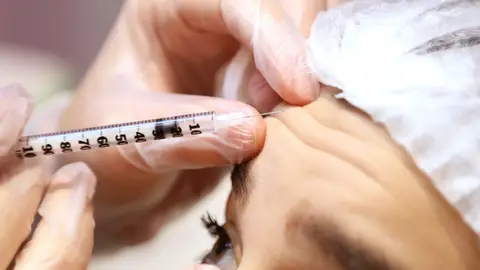 Inyección de bótox Inyección de bótox