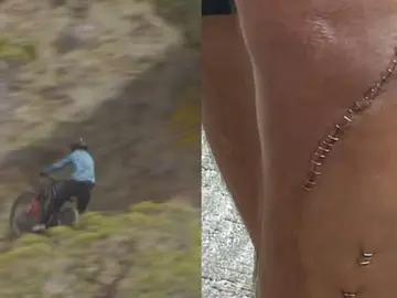El momento en el que Cam McCaul se rompe la tibia y el estado de su pierna El momento en el que Cam McCaul se rompe la tibia y el estado de su pierna