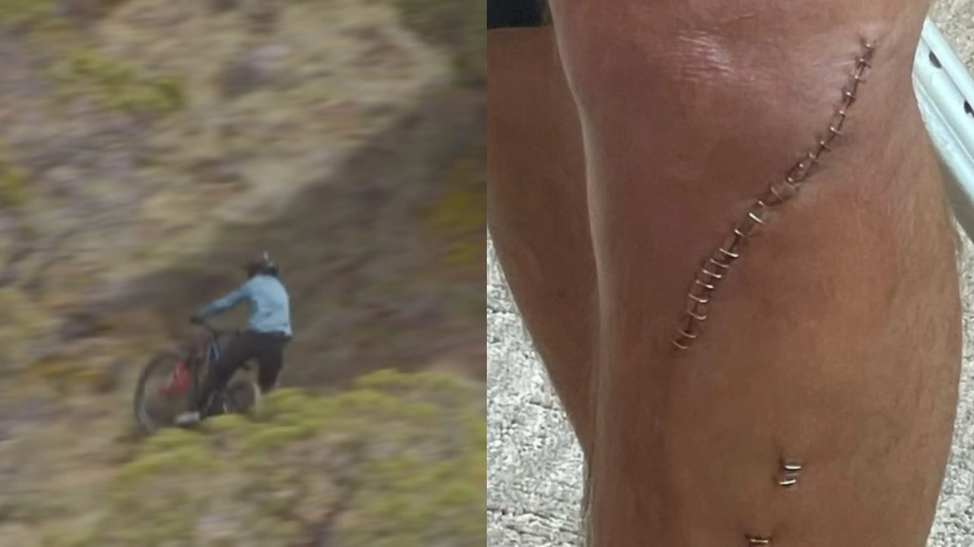 El momento en el que Cam McCaul se rompe la tibia y el estado de su pierna El momento en el que Cam McCaul se rompe la tibia y el estado de su pierna