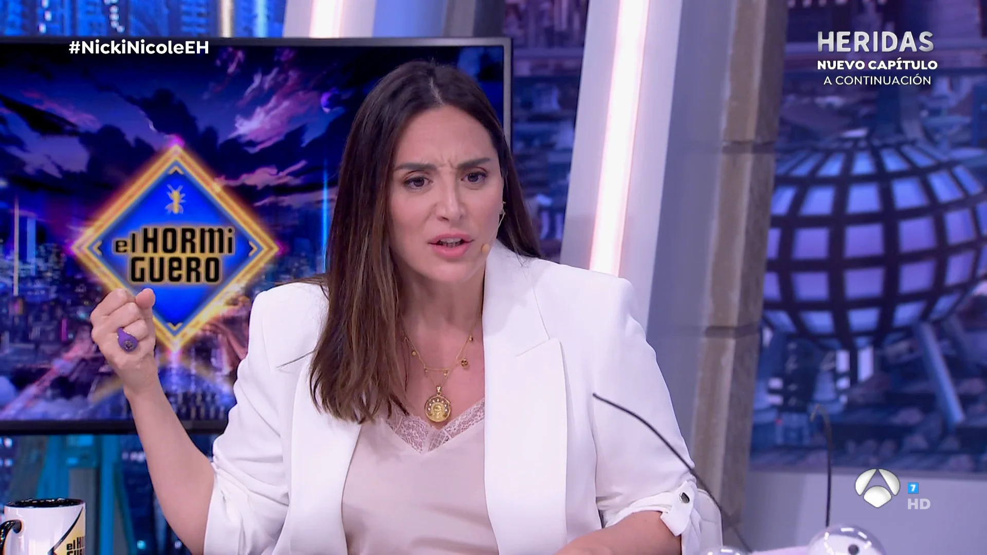 Tamara Falc&oacute; se defiende de las cr&iacute;ticas por su peso: "Nadie le ha preguntado a &Iacute;&ntilde;igo si &eacute;l quiere bajar 10 kilos"