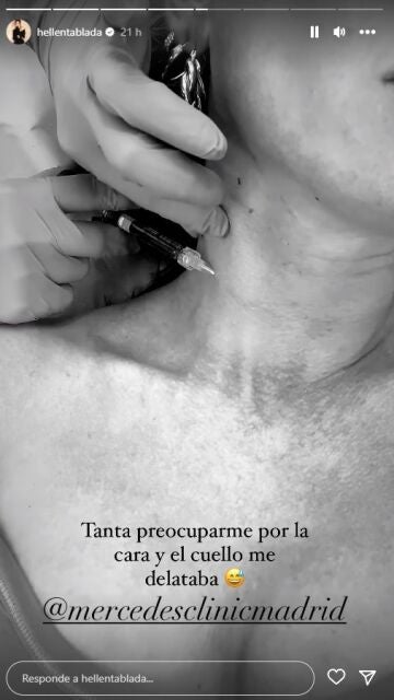 Elena Tablada comparte el tratamiento que se ha hecho en el cuello