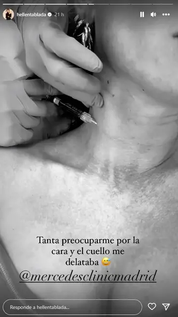 Elena Tablada comparte el tratamiento que se ha hecho en el cuello Elena Tablada comparte el tratamiento que se ha hecho en el cuello