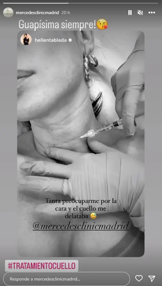 Elena Tablada se hace un tratamiento en el cuello