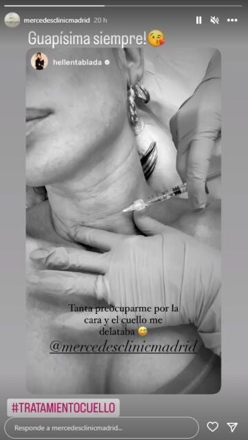 Elena Tablada se hace un tratamiento en el cuello