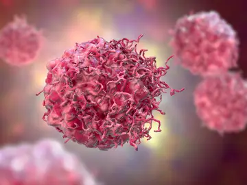 Células cancerosas Células cancerosas