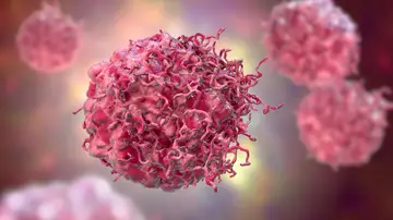 Células cancerosas Células cancerosas