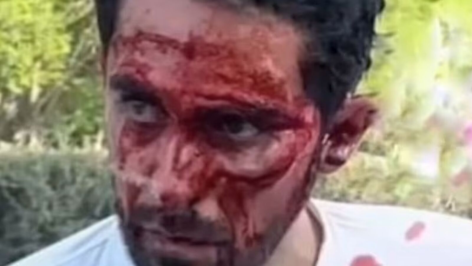 Así quedó el rostro de Alberto Contador tras una durísima caída en China