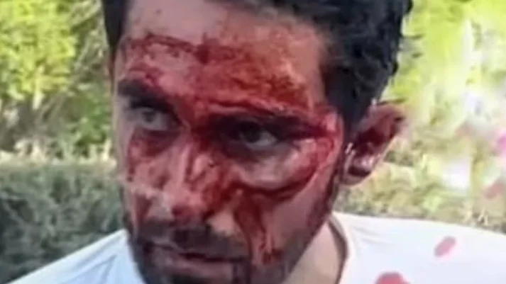 El rostro de Alberto Contador tras caerse en China El rostro de Alberto Contador tras caerse en China