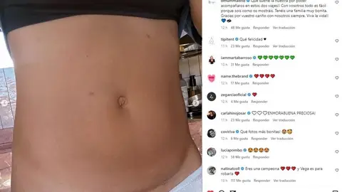 María Pombo muestra la cicatriz de su cesárea María Pombo muestra la cicatriz de su cesárea