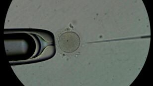 Personal t&eacute;cnico trabaja con espermatozoides en el laboratorio de una cl&iacute;nica de fertilidad.