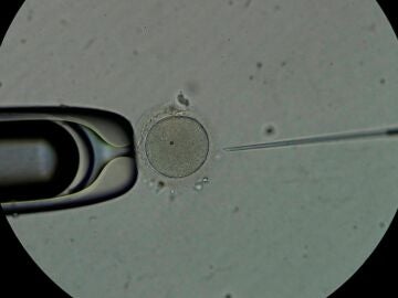 Personal técnico trabaja con espermatozoides en el laboratorio de una clínica de fertilidad.