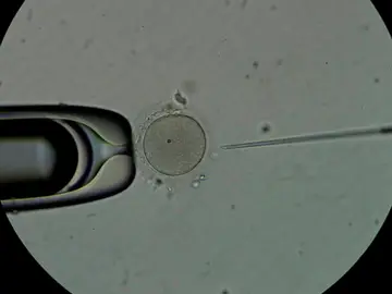 Personal técnico trabaja con espermatozoides en el laboratorio de una clínica de fertilidad. Personal técnico trabaja con espermatozoides en el laboratorio de una clínica de fertilidad.