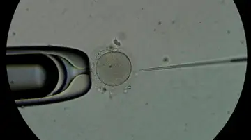 Personal técnico trabaja con espermatozoides en el laboratorio de una clínica de fertilidad. Personal técnico trabaja con espermatozoides en el laboratorio de una clínica de fertilidad.