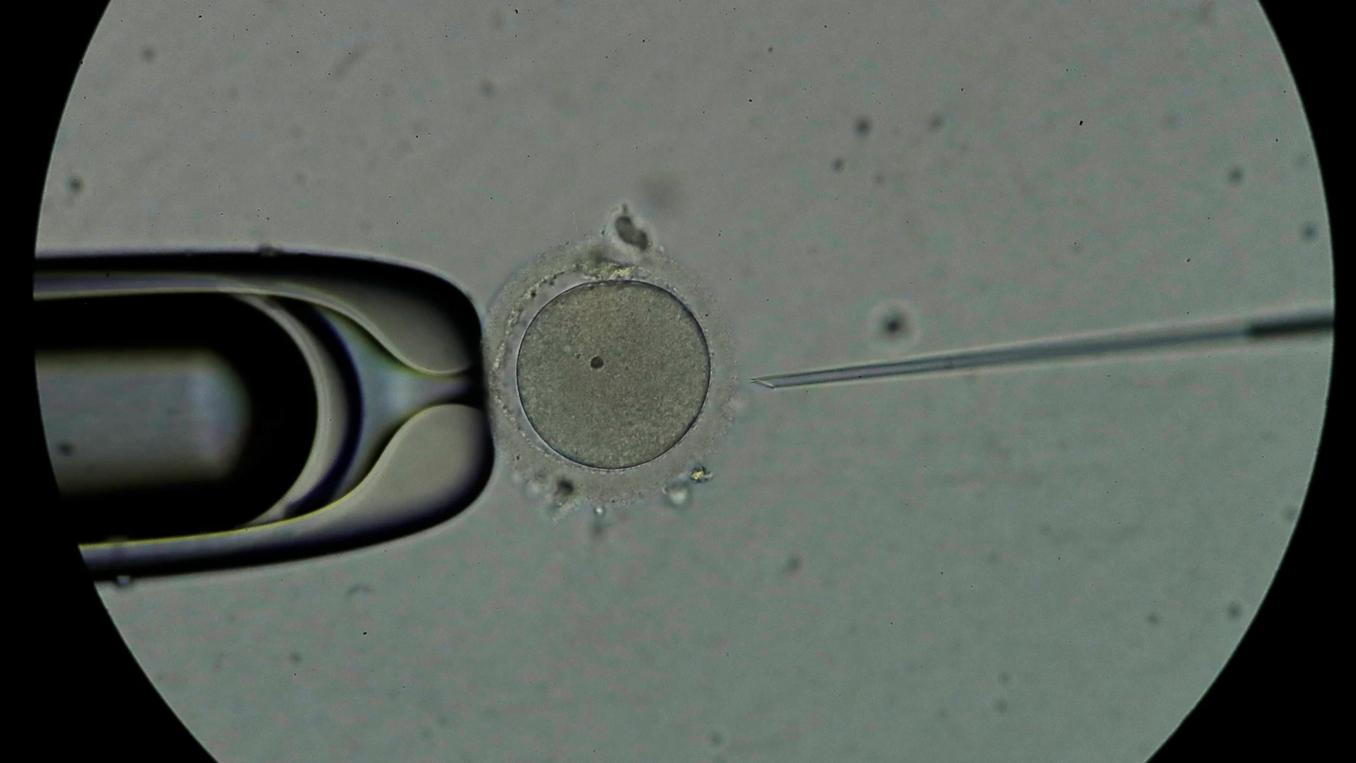 Personal técnico trabaja con espermatozoides en el laboratorio de una clínica de fertilidad.