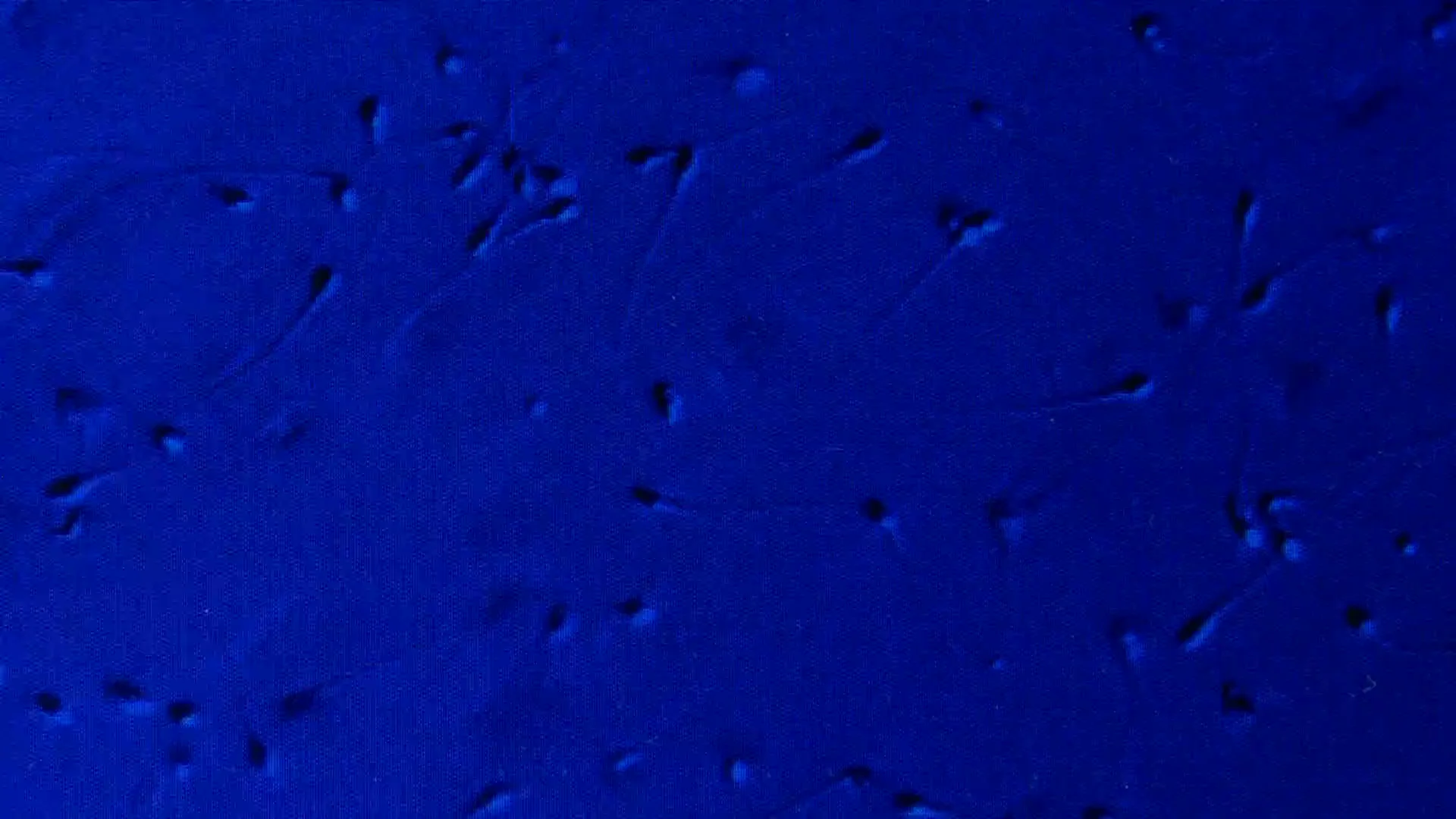 Espermatozoides Espermatozoides