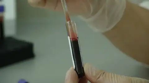 Demuestran la eficacia de una nueva inmunoterapia frente al mieloma multiple resistente Demuestran la eficacia de una nueva inmunoterapia frente al mieloma multiple resistente