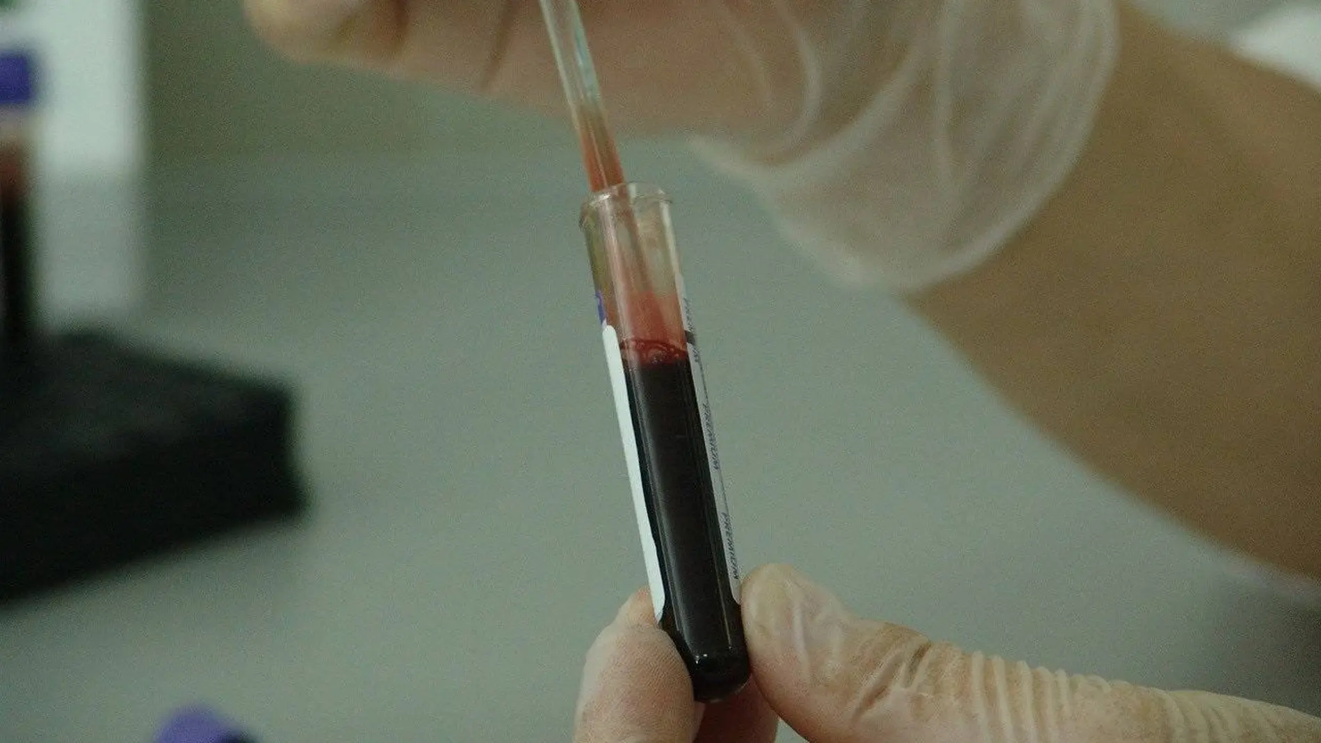 Demuestran la eficacia de una nueva inmunoterapia frente al mieloma multiple resistente Demuestran la eficacia de una nueva inmunoterapia frente al mieloma multiple resistente