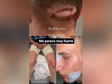 Joven agredido en Alginet (Valencia) Joven agredido en Alginet (Valencia)